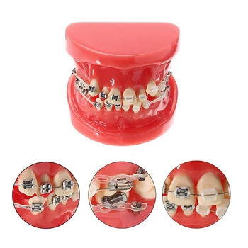 Модель ортодонтического лечения у стоматолога с керамическим металлическим кронштейном, модель ортодонтических зубов из смолы